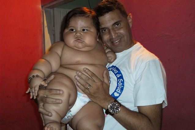 Самые большие дети в мире: 8-месячный ребенок весом 20 кг и другие
